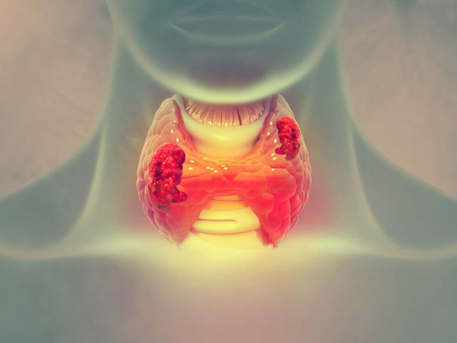 Tratamientos-2-cancer-de-tiroides-ilustracion-3d